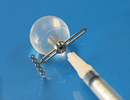 Image: The Integrated Orbital Tissue Expander (photo courtesy Innovia). Image: The Integrated Orbital Tissue Expander (photo courtesy Innovia).
